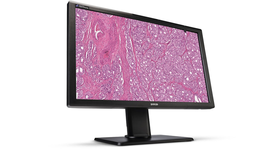 Écran Barco MDPC-8127 – 27 pouces 8 MP pour la pathologie numérique